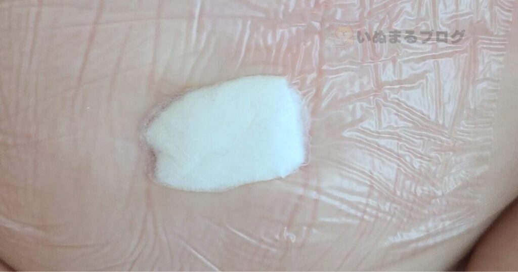 綿球と防水フィルムで圧迫療法をしている様子